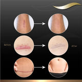 Dermatix Scar Gel 60g-O Sullivans Pharmacy