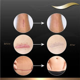 Dermatix Silicone Sheet Clear 4 x 13cm - O'Sullivans Pharmacy