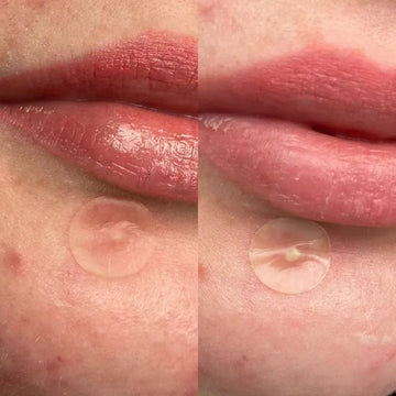 Hero Mighty Patch Original 24 Pack - O'Sullivans Pharmacy