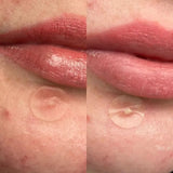 Hero Mighty Patch Original 24 Pack - O'Sullivans Pharmacy