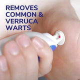 Scholl Freeze Away Max Verruca & Wart Remover - O'Sullivans Pharmacy