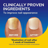 Scholl Nail Revitaliser Serum 10ml - O'Sullivans Pharmacy
