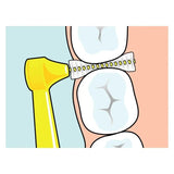 TePe Angle Yellow Interdental Brushes (Size 4) 6 Pack - O'Sullivans Pharmacy