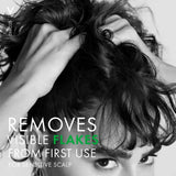 Vichy Dercos Anti - Dandruff Shampoo for Sensitive Scalp 200ml - O'Sullivans Pharmacy