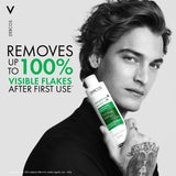 Vichy Dercos Anti-Dandruff Shampoo for Oily Hair and Scalp 200ml - O'Sullivans Pharmacy - Toiletries - 3337871330286