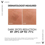 Vichy Liftactiv Specialist B3 Dark Spots Serum 30ml - O'Sullivans Pharmacy - Skincare - 3337875734905